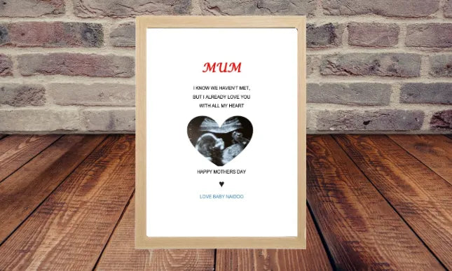 personalised-baby-ultrasound-picture-frame-including-delivery