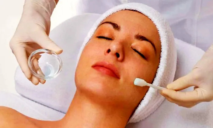 chemical-peel-and-led-light-combo