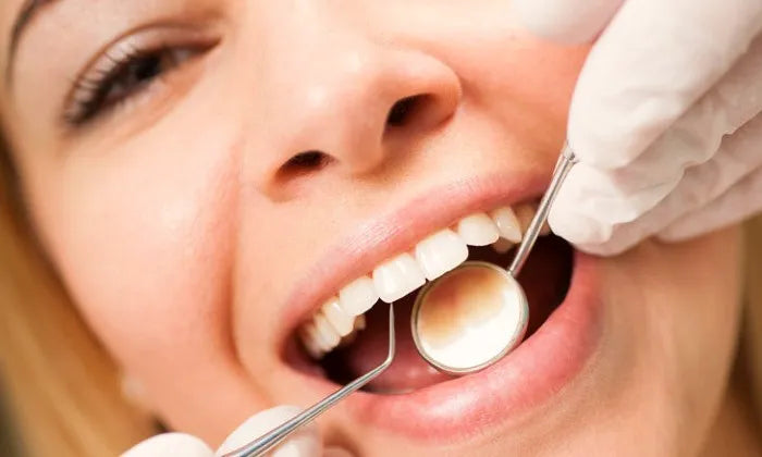 consultation-teeth-cleaning-or-teeth-whitening-session