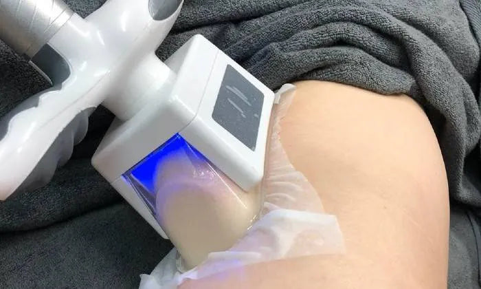 cryolipolysis-treatment-including-ultrasonic-cavitation-and-radio-frequency-treatment-from-la-glace-beauty-clinic