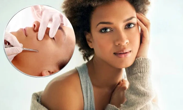 Dermaplaning session – Hyperli