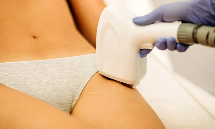 laser-hair-removal-sessions