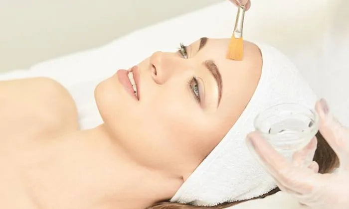 full-face-microneedling-with-1-x-chemical-peel-procedure-at-michandra-slimming-beauty-studio