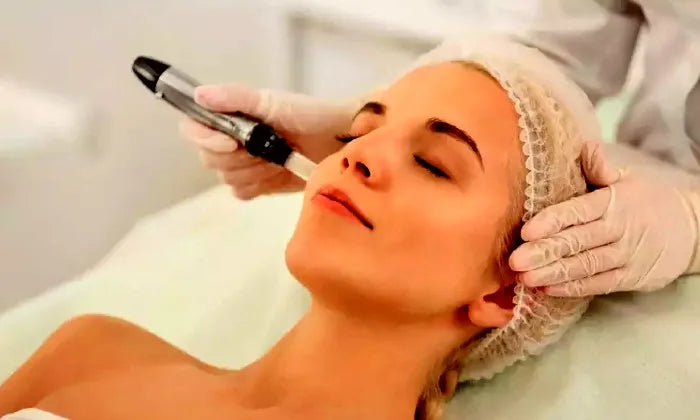 microneedling-session