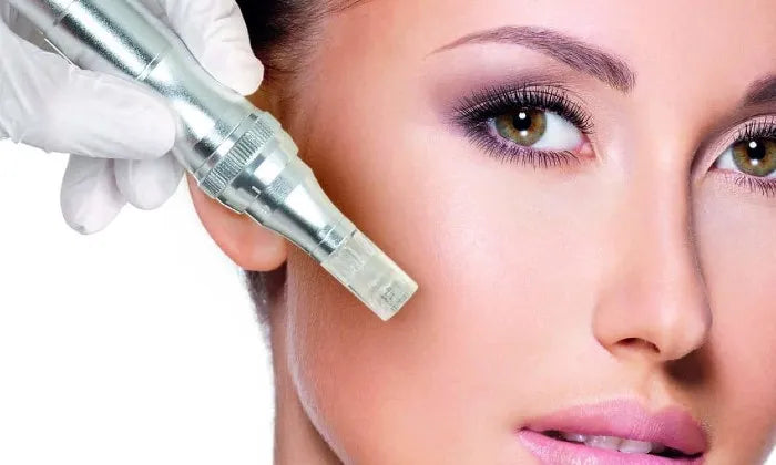 microneedling-session