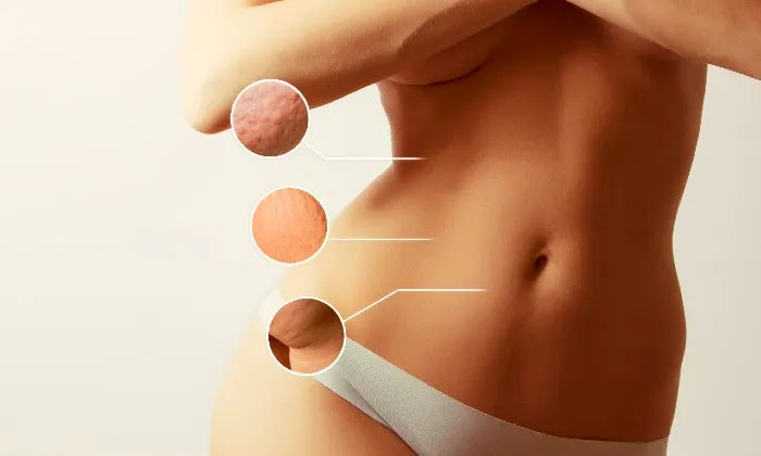 3-or-6-x-60-minute-cavitation-slimming-including-fir-sauna-treatment-at-nu-you