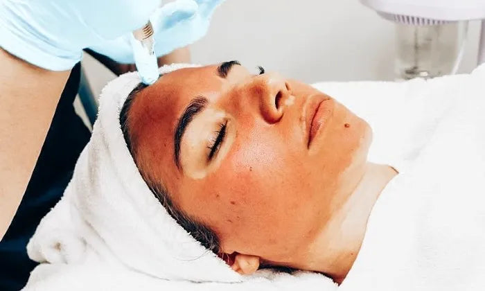 glow-combo-dermaplaning-peel-and-microneedling-at-pure-skin