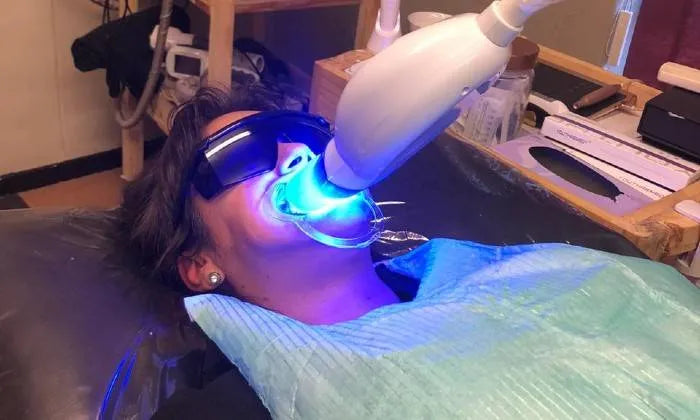 teeth-whitening-session-from-la-glace-beauty-clinic